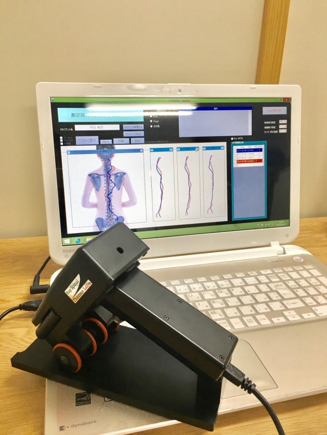 サーモグラフィー検査。柏市で整体なら宮田カイロプラクティックにお任せください。
